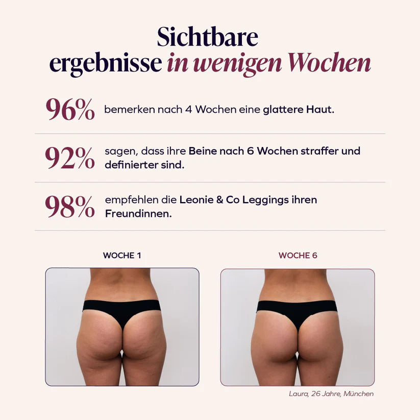 3D-Leggings | Zwart